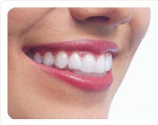 Click to enlarge image invisalign-1.jpg
