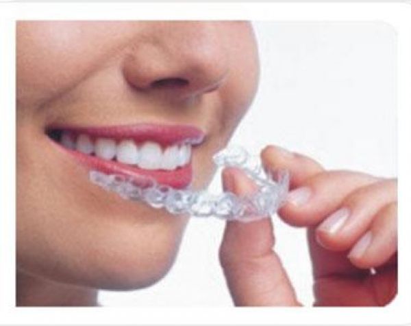 Click to enlarge image invisalign-2.jpg