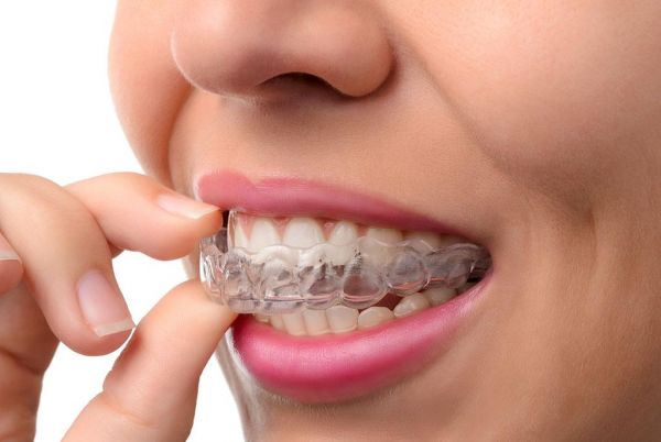 Click to enlarge image invisalign-new-2.jpg